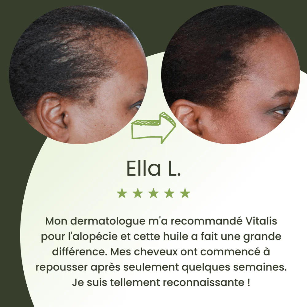 Sérum de croissance pour cheveux (60ml)