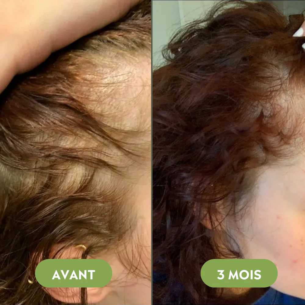 Sérum de croissance pour cheveux (60ml)
