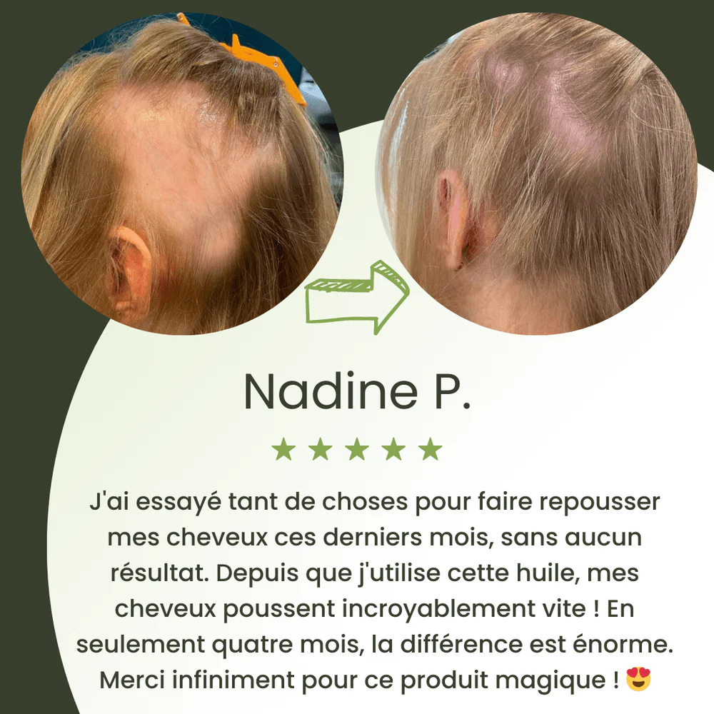 Sérum de croissance pour cheveux (60ml)