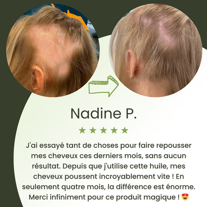 Sérum de croissance pour cheveux (60ml)