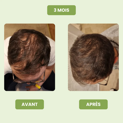 Sérum de Croissance Capillaire pour Hommes