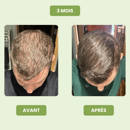 Sérum de Croissance Capillaire pour Hommes