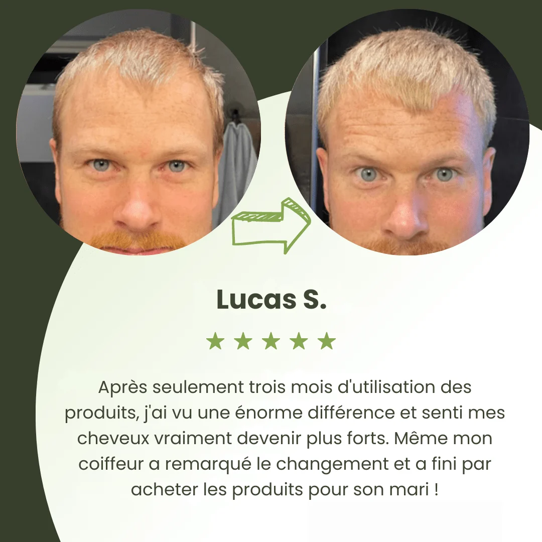 Sérum de Croissance Capillaire pour Hommes