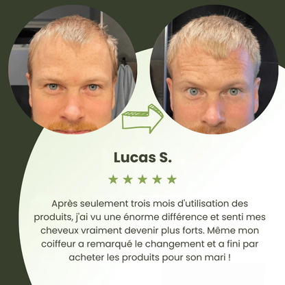 Sérum de Croissance Capillaire pour Hommes